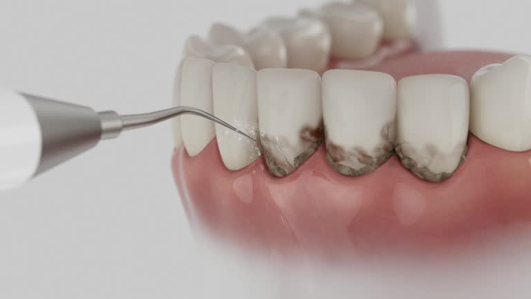 Reliable Dental Implants contractor in Auburn, KS by Smile Center Dentistry